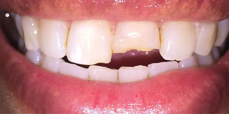 Before dental treatment