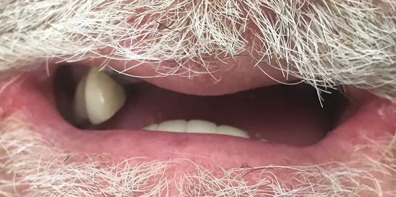 Before dental treatment