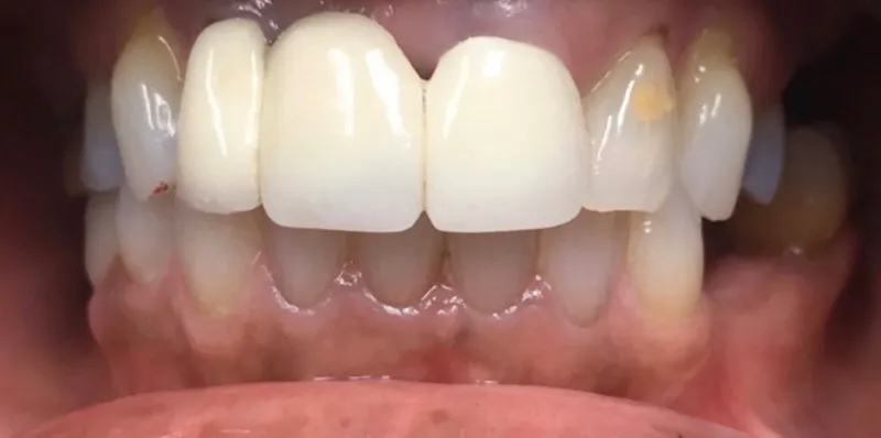 Before dental treatment
